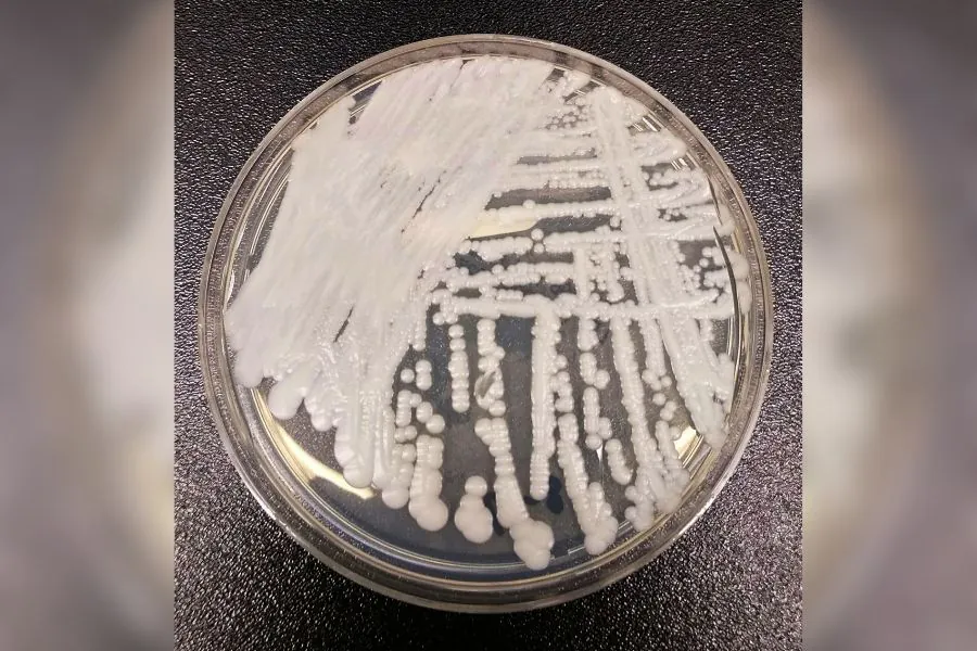 Sesap confirma caso de super fungo Candida auris em paciente internado em hospital de Natal