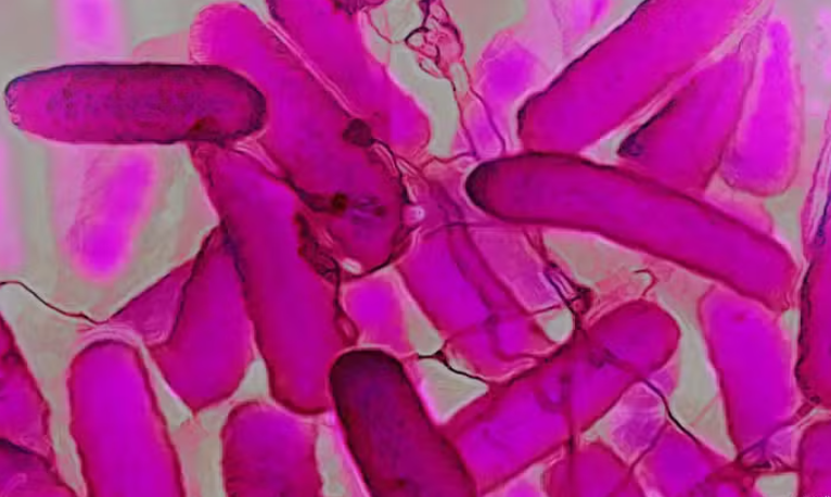 Síndrome da autocervejaria faz pacientes “ficarem bêbados” sem consumir álcool