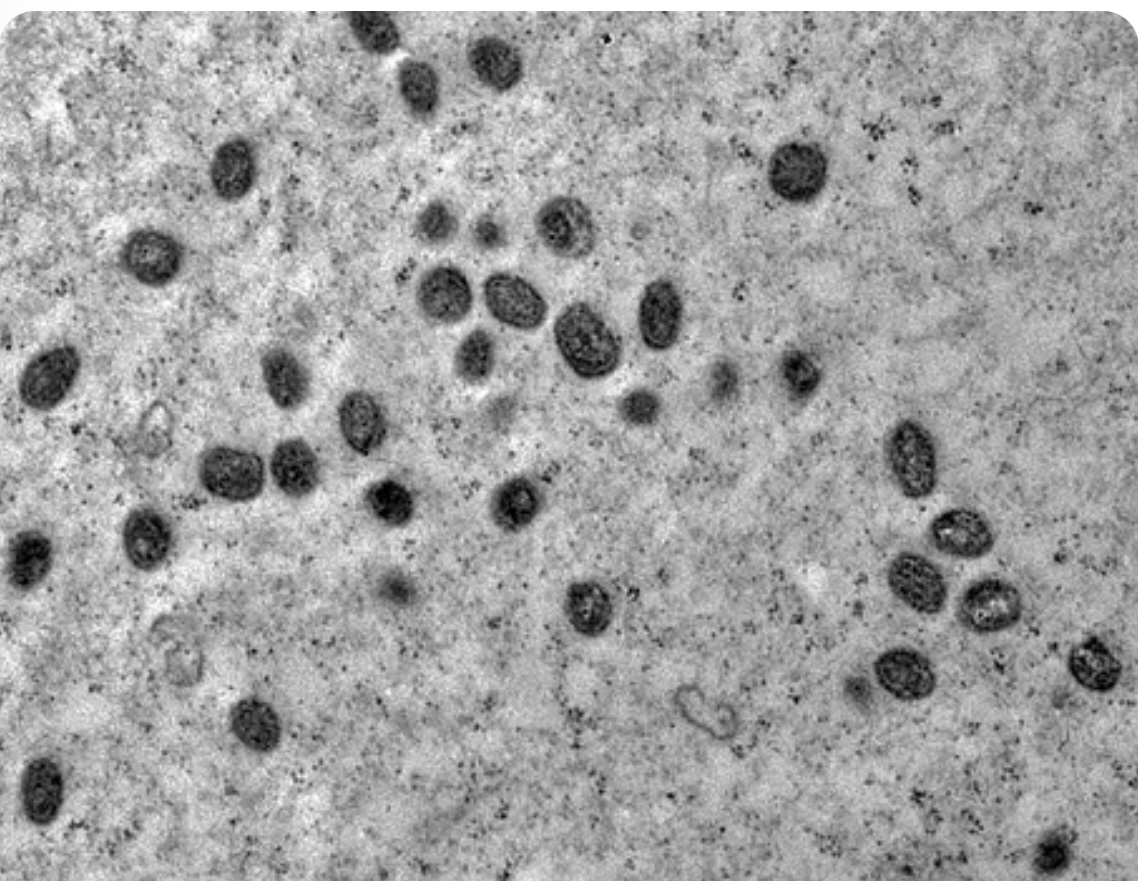 RN registra três novos casos de Mpox; pacientes estão em isolamento domiciliar