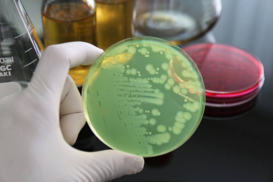 Bactéria encontrada em produtos de limpeza pode causar infecções graves; entenda os riscos